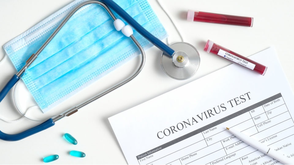 Test tampone coronavirus negativo