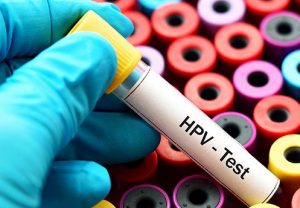 hpv